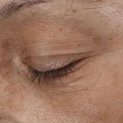 Bio - Renew EGF Eye Cream - Glo Skin Beauty UK&I