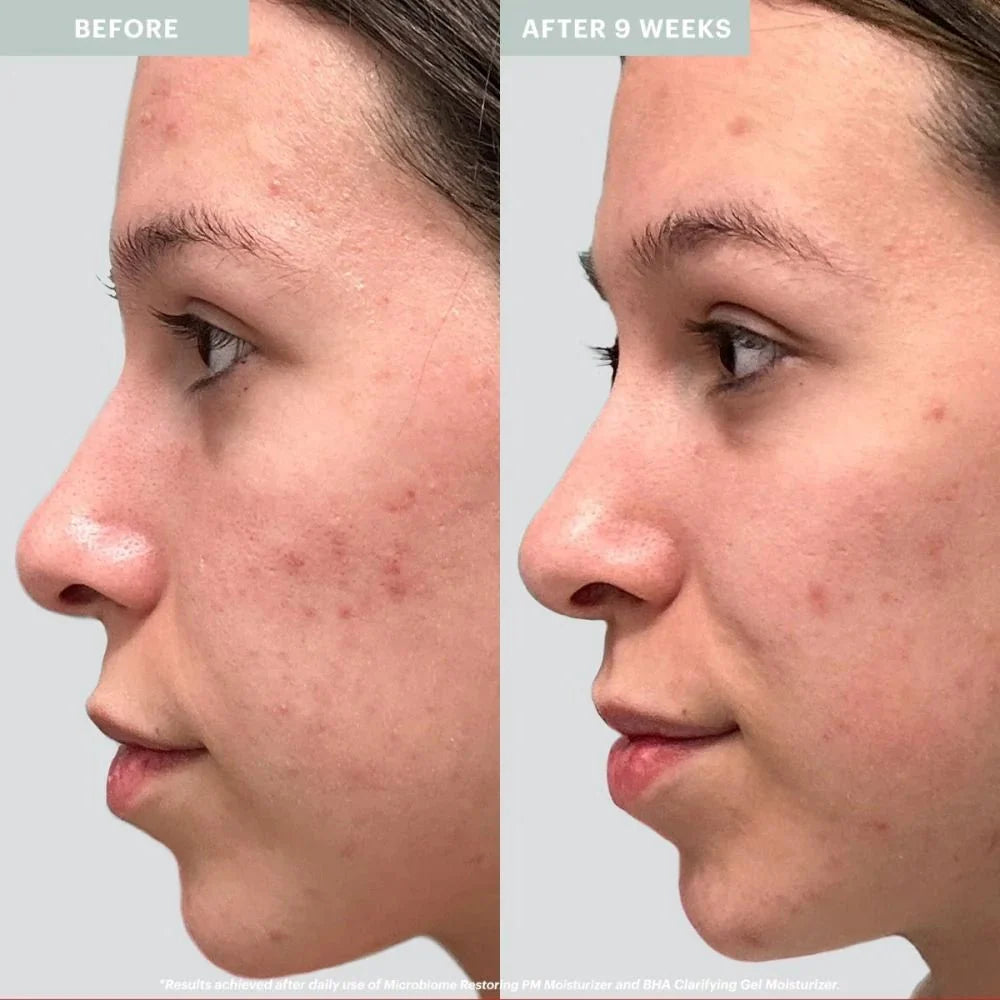 Microbiome Restoring PM Moisturizer - Glo Skin Beauty UK&I